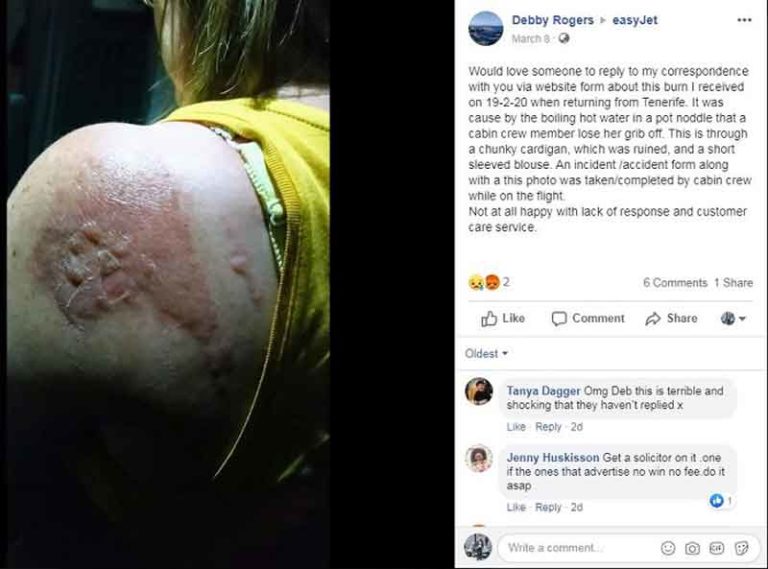 Pramugari EasyJet Bikin Tubuh Penumpang Melepuh Akibat Ketumpahan Mie