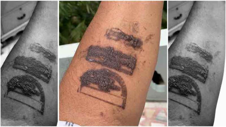 Viral, Penumpang Pesawat Keluhkan Stempel Karantina Mandiri Depkes Bikin Kulit Terbakar